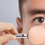 Can a Cream Help with Flaking and Skin Discomfort